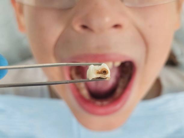 Best Cosmetic Emergency Dentistry in Garrett, WA