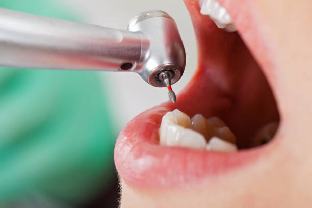 Best Emergency Root Canal Treatment in Garrett, WA